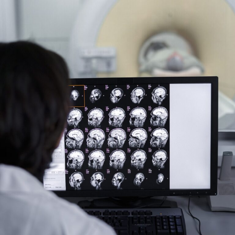 Tomografia Resomasa Javier Prado 3-min